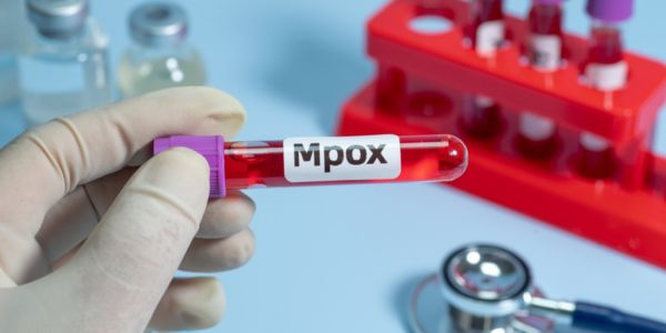 Mpox o viruela del mono: Lo que debes saber sobre la alerta sanitaria reciente